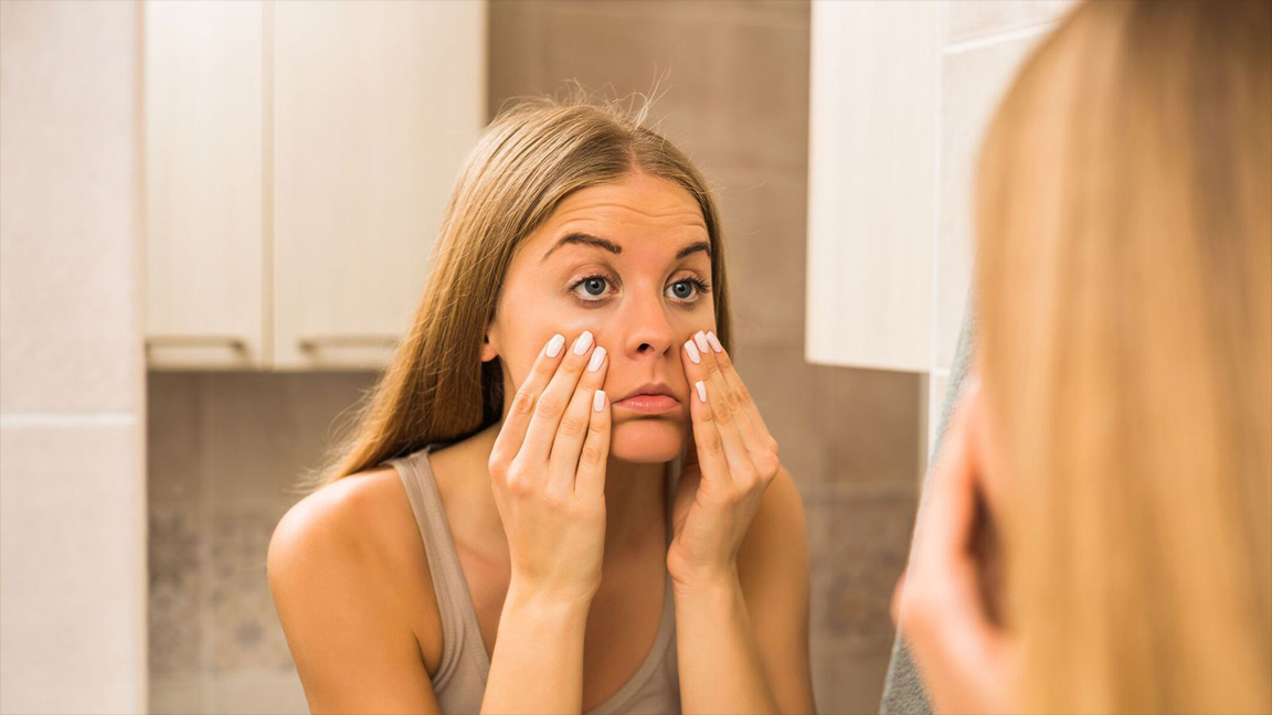 Under Eye Bags: Age vs. Lifestyle – What Doctors Say