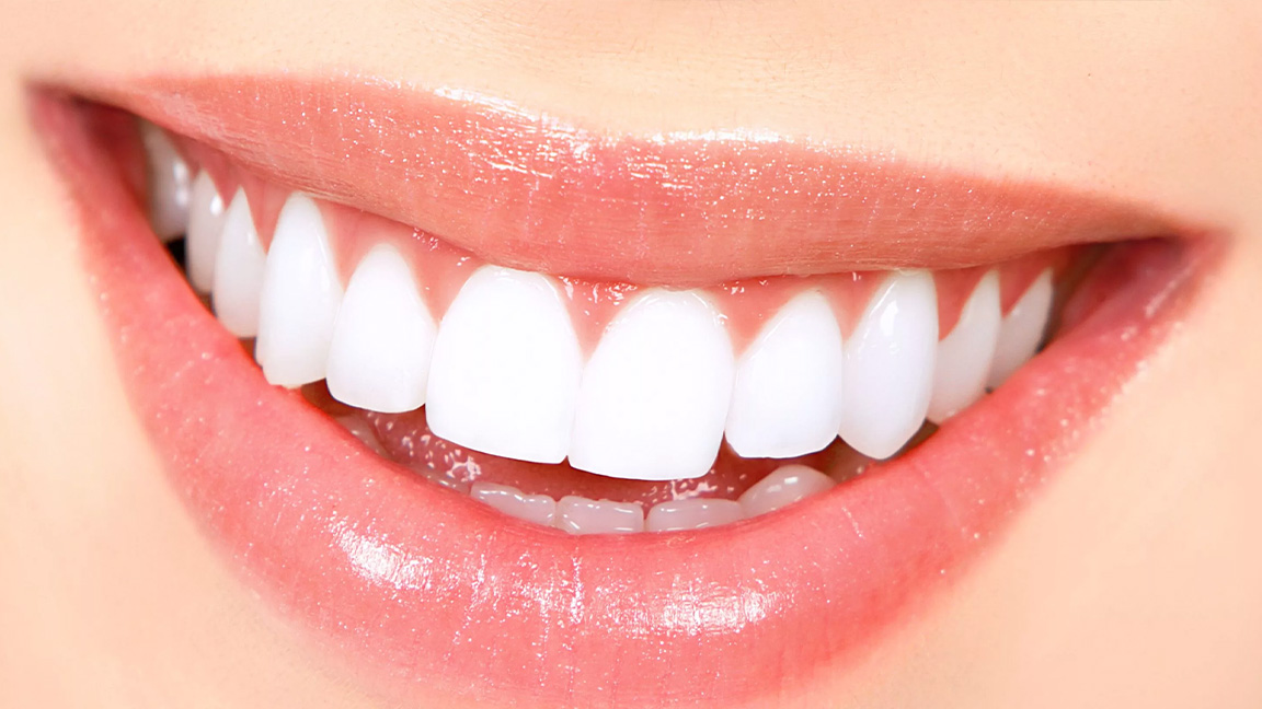 I Tried TikTok’s “5-Minute Teeth Whitening” Hacks: Here’s What Happened