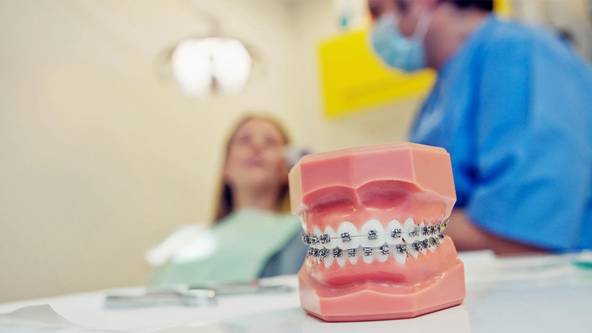 Invisalign vs. Braces: Pros Beyond the Aesthetic
