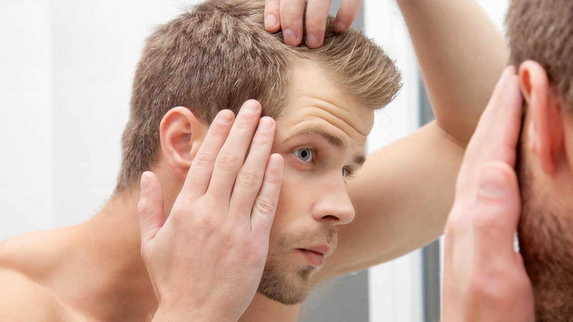 How Long Does a Hair Transplant Really Last?