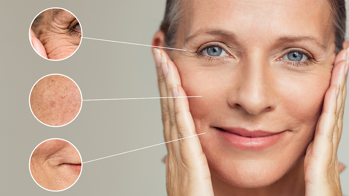 How My Skin Changed After 6 Months of Microneedling