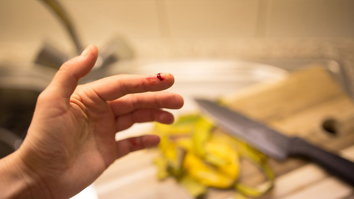 Do Band-Aids Help or Hinder Cut Healing?