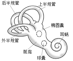梅尼埃病