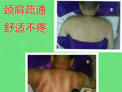 安逸烜经络养生理疗中心养生加盟 38.4万起投资 实地考察选址 总部统一装修 缩略图 3