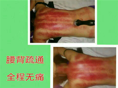 安逸烜经络养生理疗中心养生加盟 38.4万起投资 实地考察选址 总部统一装修 缩略图 4